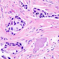 Anatomo-cyto-pathologie